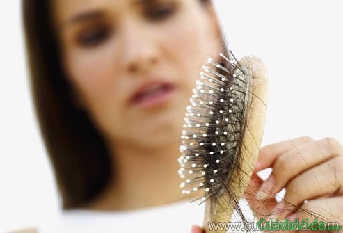 No es bueno ignorar la alopecia