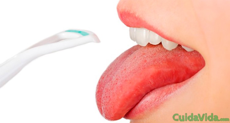 Causas de tener la lengua blanca